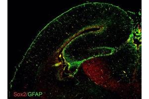 IHC-Fr Image GFAP antibodies detects GFAP proteins on embryonic mouse brain by immunohistochemical analysis. (GFAP antibody)