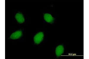 Immunofluorescence (IF) image for anti-Calbindin (CALB1) (AA 1-261) antibody (ABIN513946)