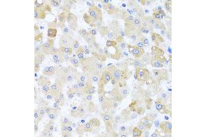 Immunohistochemistry of paraffin-embedded human liver injury using CETN1 antibody at dilution of 1:100 (x40 lens).
