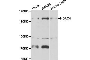 Western blot analysis of extracts of various cell lines, using HDAC4 antibody. (HDAC4 antibody)