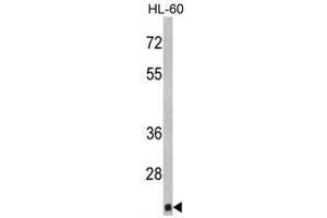 Image no. 1 for anti-Core-Binding Factor, beta Subunit (CBFB) (Middle Region) antibody (ABIN452819) (CBFB antibody  (Middle Region))