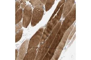 Immunohistochemical staining of human skeletal muscle with FAM198B polyclonal antibody  shows strong cytoplasmic positivity in myocytes.