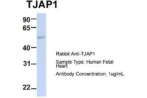 Host:  Rabbit  Target Name:  TJAP1  Sample Type:  Human Fetal Heart  Antibody Dilution:  1. (TJAP1 antibody  (N-Term))