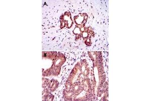 Immunohistochemical analysis of paraffin-embedded human prostate tissue (A) and colon cancer tissue (B) using OTX2 monoclonal antobody, clone 1H12C4B5  with DAB staining.