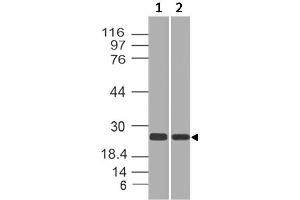 Image no. 1 for anti-RAP2A, Member of RAS Oncogene Family (RAP2A) antibody (ABIN5027782) (RAP2A antibody)