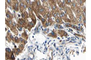ABIN6266833 at 1/100 staining human liver tissue sections by IHC-P. (ARMCX3 antibody  (N-Term))
