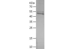 Western Blotting (WB) image for YTH Domain Family, Member 2 (YTHDF2) (AA 365-579) protein (His-IF2DI Tag) (ABIN7283925) (YTHDF2 Protein (AA 365-579) (His-IF2DI Tag))