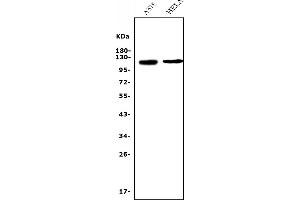 Western blot analysis of CD146/MCAM using anti-CD146/MCAM antibody (ABIN7602098). (MCAM antibody  (AA 59-401))