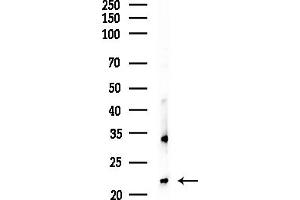 anti-RAB1B, Member RAS Oncogene Family (RAB1B) (Internal Region) antibody