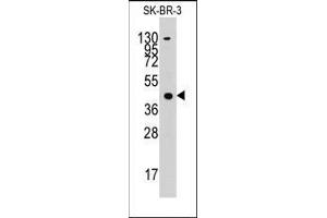 Western blot analysis of anti-ACAT1 Pab in SK-BR-3 cell line lysates (35ug/lane). (ACAT1 antibody  (C-Term))