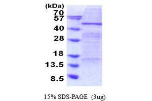 SDS-PAGE (SDS) image for Elongator Acetyltransferase Complex Subunit 4 (ELP4) (AA 1-424) protein (His tag) (ABIN5853922) (ELP4 Protein (AA 1-424) (His tag))