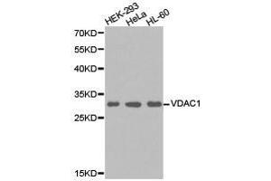 Western Blotting (WB) image for anti-Voltage-Dependent Anion Channel 1 (VDAC1) antibody (ABIN1875318) (VDAC1 antibody)