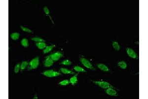 Immunofluorescent analysis of Hela cells using ABIN7163755 at dilution of 1:100 and Alexa Fluor 488-congugated AffiniPure Goat Anti-Rabbit IgG(H+L) (PARP3 antibody  (AA 294-533))