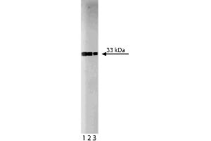 Western blot analysis of Cdk2 on a Jurkat lysate. (CDK2 antibody  (AA 109-298))