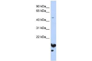 NUSAP1 antibody used at 1 ug/ml to detect target protein. (NUSAP1 antibody  (Middle Region))