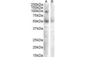 Western Blotting (WB) image for anti-Sulfatase 2 (SULF2) (AA 545-560) antibody (ABIN490407) (SULF2 antibody  (AA 545-560))