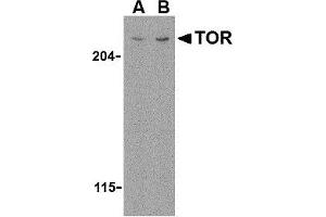 Western Blotting (WB) image for anti-RAR-Related Orphan Receptor C (RORC) (N-Term) antibody (ABIN1031636) (RORC antibody  (N-Term))