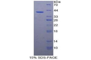 SDS-PAGE analysis of Rabbit VCAM1 Protein. (VCAM1 Protein)