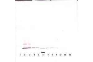 Image no. 4 for anti-Chemokine (C-C Motif) Ligand 8 (CCL8) antibody (ABIN465585) (CCL8 antibody)