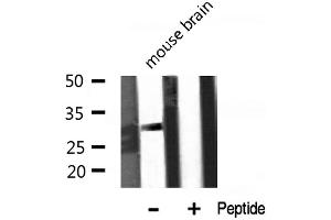 Western blot analysis of KCNMB2 expression in Mouse brain lysate (KCNMB2 antibody  (Internal Region))