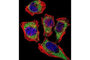 Fluorescent confocal image of Hela cell stained with CA2 Antibody (N-term) (ABIN652314 and ABIN2841442). (CA2 antibody  (N-Term))