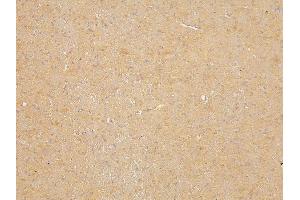 IHC analysis of SLC12A5 using anti-SLC12A5 antibody (ABIN6719415).