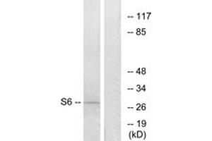 Western blot analysis of extracts from 293 cells, treated with serum 10% 15', using S6 Ribosomal Protein (Ab-235) Antibody. (RPS6 antibody  (AA 196-245))
