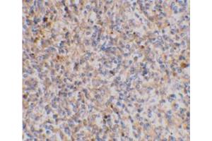 Immunohistochemical staining of human spleen tissue using AP30988PU-N at 2 μg/ml. (XAF1 antibody  (C-Term))