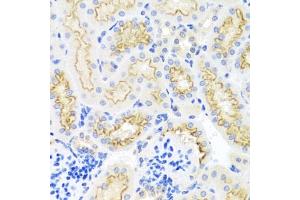 Immunohistochemistry of paraffin-embedded mouse kidney using SRPX antibody  at dilution of 1:100 (40x lens). (SRPX antibody  (AA 40-320))