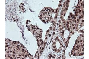 Image no. 2 for anti-Fetal and Adult Testis Expressed 1 (FATE1) antibody (ABIN1498222) (FATE1 antibody)