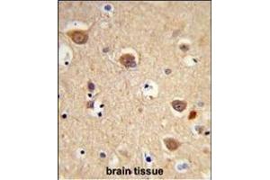 Immunohistochemistry (Paraffin-embedded Sections) (IHC (p)) image for anti-Apoptosis-Inducing Factor, Mitochondrion-Associated, 1 (AIFM1) (AA 70-98), (N-Term) antibody (ABIN652856)