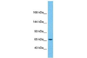 Host:  Rabbit  Target Name:  ZNF681  Sample Type:  Pancreas Tumor lysates  Antibody Dilution:  1. (ZNF681 antibody  (Middle Region))