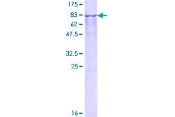 TFG Protein (AA 1-400) (GST tag)