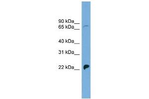 WB Suggested Anti-SLC5A5 Antibody Titration: 0. (SLC5A5 antibody  (N-Term))