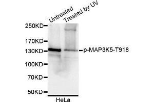 Western blot analysis of extracts of HeLa cell line, using Phospho-MAP3K5-T918 antibody. (ASK1 antibody  (pThr918))