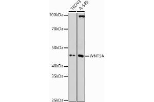 Western blot analysis of extracts of various cell lines, using WNT5A antibody (ABIN3023002, ABIN3023003, ABIN3023004 and ABIN6219340) at 1:1000 dilution. (WNT5A antibody  (AA 101-380))