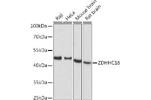 Western blot analysis of extracts of various cell lines, using ZDHHC18 Rabbit pAb (ABIN7271549) at 1:1000 dilution. (ZDHHC18 antibody  (AA 301-388))
