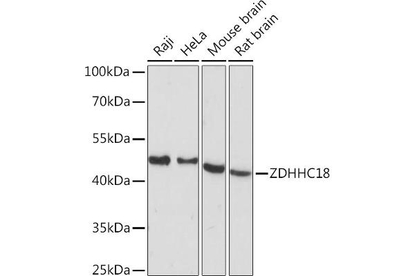 ZDHHC18 anticorps  (AA 301-388)