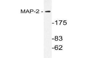 Western blot (WB) analysis of MAP-2 antibody in extracts from mouse brain cells. (MAP2 antibody)