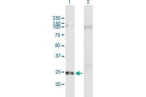 Lane 1: RND1 transfected lysate ( 26.