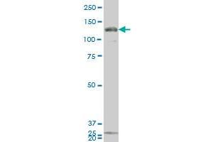 GUCY2C monoclonal antibody (M02), clone 1B11 Western Blot analysis of GUCY2C expression in 293 . (GUCY2C antibody  (AA 24-133))