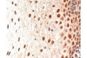 ABIN2564393 (3µg/ml) staining of paraffin embedded Human Oesophagus. (Paired Box 3 antibody  (N-Term))