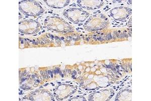 Immunohistochemistry analysis of paraffin-embedded rat colon using,OAS3 (ABIN7072846) at dilution of 1: 4000
