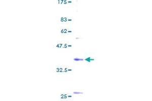 BET1 Protein (AA 1-118) (GST tag)