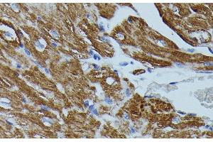 Immunohistochemistry of paraffin-embedded Mouse heart using FKBP1B Polyclonal Antibody at dilution of 1:100 (40x lens). (FKBP1B antibody)