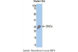 Detection of Recombinant RBP4, Mouse using Polyclonal Antibody to Retinol Binding Protein 4 (RBP4) (RBP4 antibody  (AA 63-245))