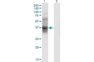 Western Blot analysis of IL2RA expression in transfected 293T cell line by IL2RA monoclonal antibody (M04), clone 1D6. (CD25 antibody  (AA 22-122))
