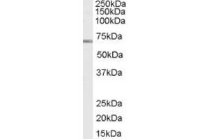 Western Blotting (WB) image for anti-Deleted in Azoospermia-Like (DAZL) (C-Term) antibody (ABIN2156674) (DAZL antibody  (C-Term))