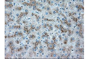 Immunohistochemical staining of paraffin-embedded pancreas tissue using anti-SERPINA1mouse monoclonal antibody. (SERPINA1 antibody)