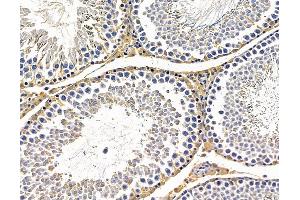 ABIN7096440 and ABIN7100504 at 1/100 staining rat testis tissue by IHC-P.